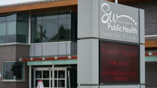 Canadá pierde el estatus de país libre de sarampión