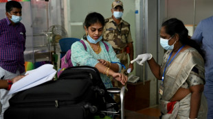 Variole du singe: 21 cas aux Etats-Unis, plus de 700 dans le monde (autorit&eacute;s am&eacute;ricaines)