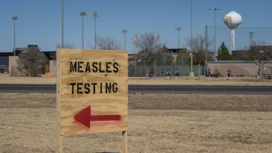 L'épidémie de rougeole aux Etats-Unis dépasse les 1.000 cas et trois morts