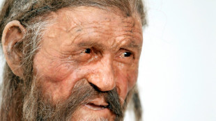 &Ouml;tzi, o 'homem das neves' era calvo e de pele mais escura do que se pensava
