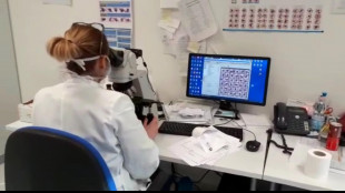 Di rene i primi organoidi ibridi, facili da coltivare