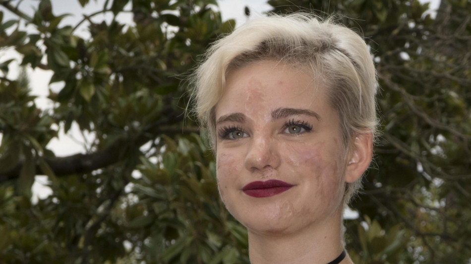 Bebe Vio, "guardavo sempre i Cesaroni quando ero in ospedale"