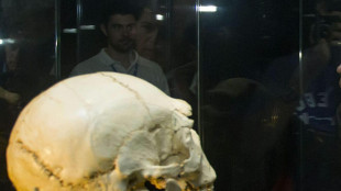 Dal tartaro antico nuova luce sulla medicina preistorica