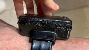 Beschädigte Fußfessel: Brasiliens Ex-Präsident Bolsonaro wegen Fluchtgefahr inhaftiert