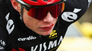 Paris-Nice: Vingegaard chute et repart avec la l&egrave;vre en sang

