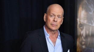 L'acteur Bruce Willis souffre d'aphasie et met fin &agrave; sa carri&egrave;re