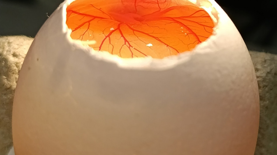 Un avatar tridimensionale per comprendere l'osteosarcoma pediatrico